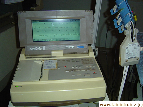 Old-fashioned ECG machine in use in the clinic, the screen still shows my heart rhythm after the technician leaves the room