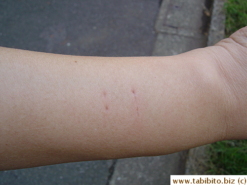 More teeth marks and a scratch on another side