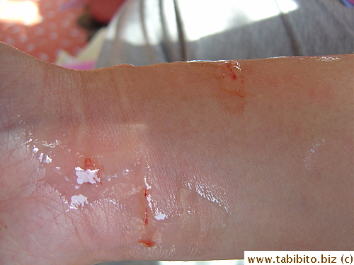 The inside of the arm suffered lots of bite marks