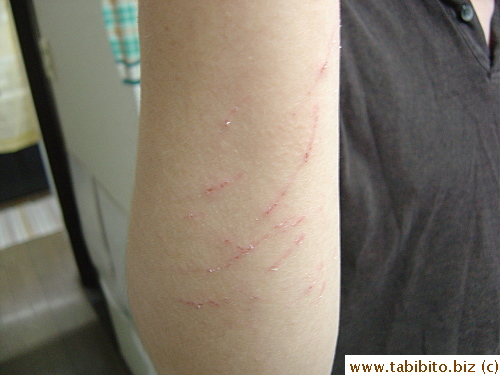 Several days later, some scratches almost healed