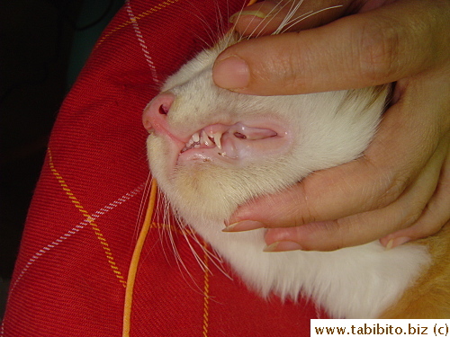 Permanent tooth emerging
