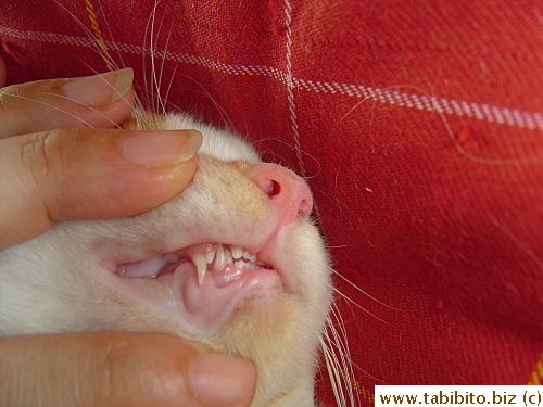 The permanent tooth grew quickly in just a couple of days